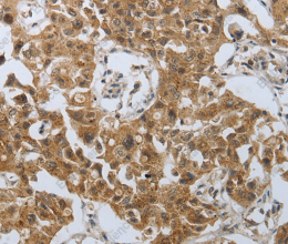 PSMD6 Polyclonal Antibody - 3