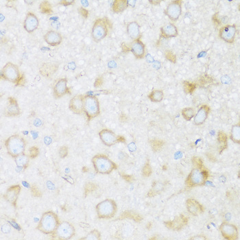 Immunohistochemistry of paraffin-embedded Rat brain using BRSK1 Polyclonal Antibody at dilution of  1:100 (40x lens).