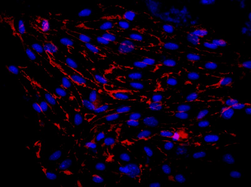 Mouse Pulmonary Great Artery Endothelial Cell Complete MediumMouse Pulmonary Great Artery Endothelial Cell Complete Medium - 2