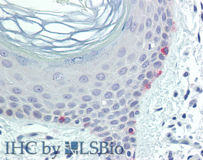 Immunohistochemistry of paraffin-embedded Skin tissue using TYR Polyclonal Antibody at dilution of 1:100 (Elabscience Product Detected by Lifespan).