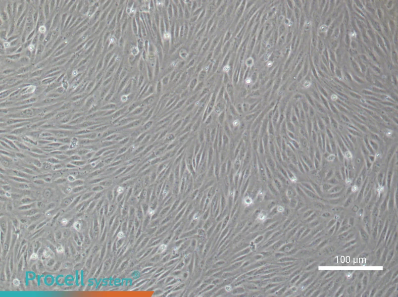 Human Choroidal Microvascular Endothelial Cell Complete Medium - 1