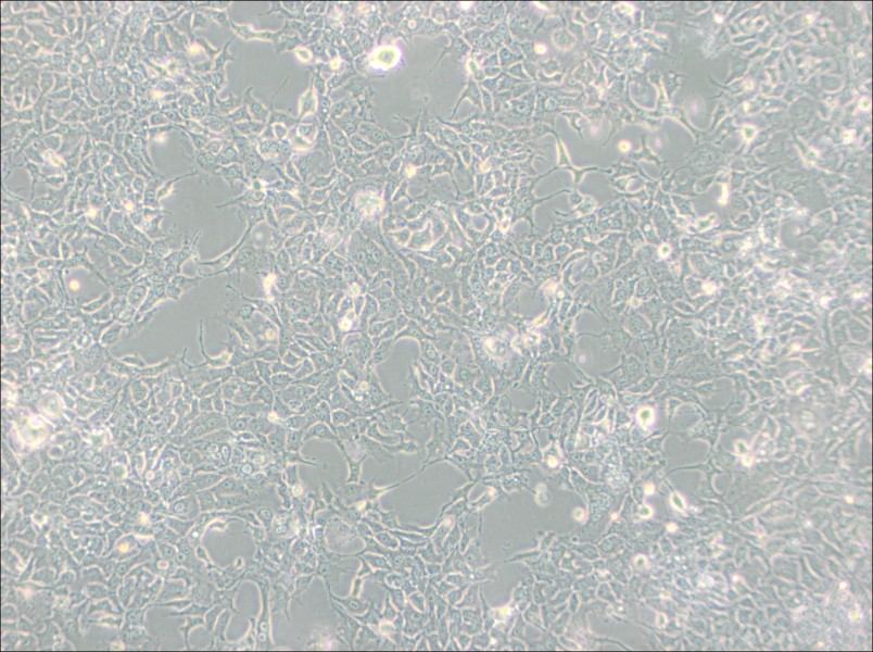 HCC827 Cell Complete MediumHCC827 Cell Complete Medium - 2