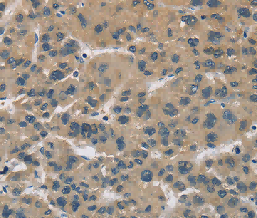 CYR61 Polyclonal Antibody - 2
