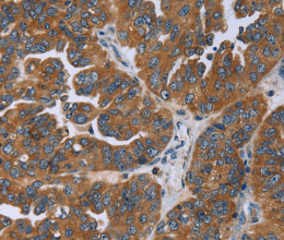 GAB2 Polyclonal Antibody - 2