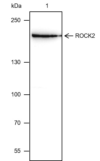 Recombinant ROCK2 Monoclonal Antibody-searchlist-1