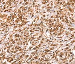 SUMO2/3/4 Polyclonal Antibody - 2