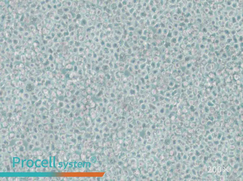 SKNO-1 Cell Complete Medium - 4