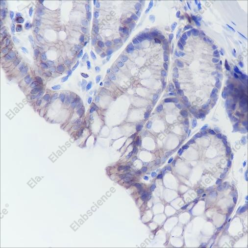 Recombinant Cadherin-17 Monoclonal Antibody - 2
