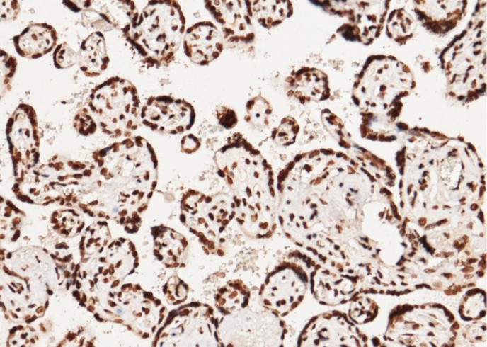 CCNE1/Cyclin-E1 Monoclonal Antibody-searchlist-1