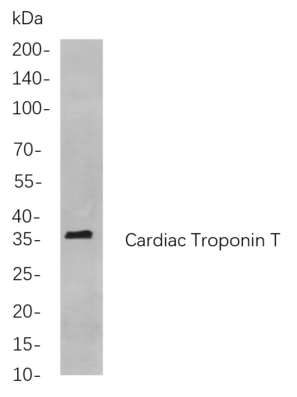 Recombinant Cardiac Troponin T Monoclonal Antibody-searchlist-1