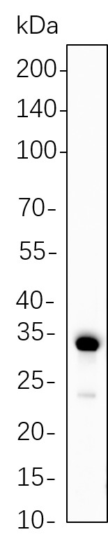 Recombinant Calponin-1 Monoclonal Antibody-searchlist-1