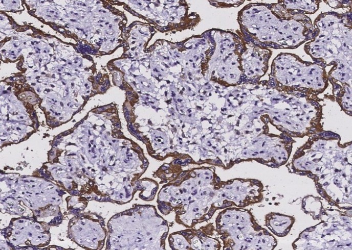 EGFR/HER1/ErbB1 Monoclonal Antibody - small - 2