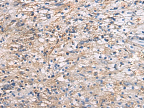 Immunohistochemistry of paraffin-embedded Human brain tissue  using CEP89 Polyclonal Antibody at dilution of 1:95(?200)