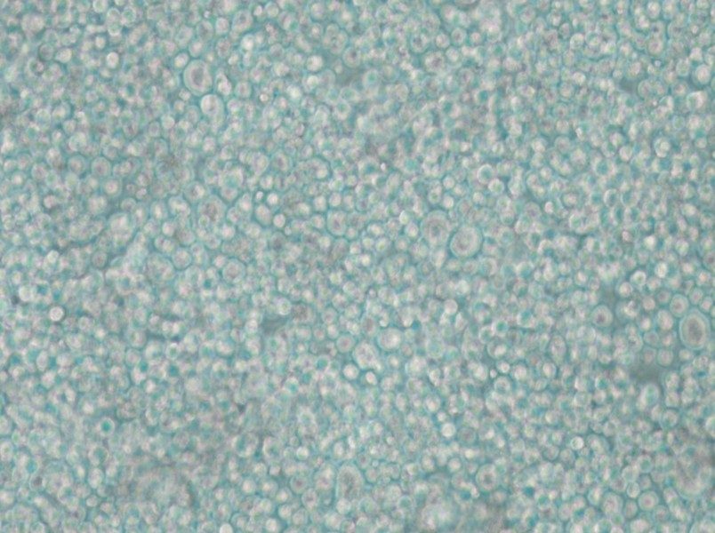 SU-DHL-2 Cell Complete Medium - small - 6