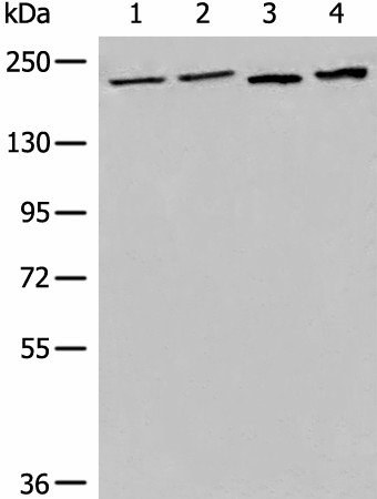 Western blot analysis of 293T cell Human metastatic malignant melanoma tissue lysates  using EEA1 Polyclonal Antibody at dilution of 1:700