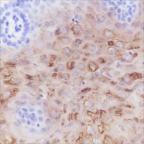 Recombinant Keratin 4 Monoclonal Antibody - 1