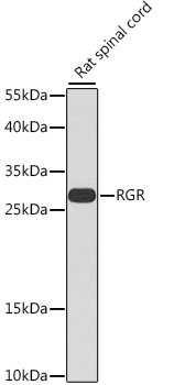 Western blot analysis of extracts of Rat spinal cord using RGR Polyclonal Antibody at dilution of 1:1000.