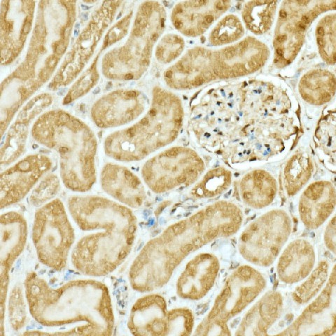 Immunohistochemistry of paraffin-embedded mouse kidney using NRF2 Polyclonal Antibody at dilution of 1:200 (40x lens).Perform high pressure antigen retrieval with 10 mM citrate buffer pH 6.0 before commencing with IHC staining protocol.