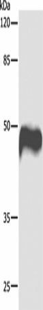 Western blot analysis of Hela cells  using CASP1 Polyclonal Antibody at dilution of 1:1000