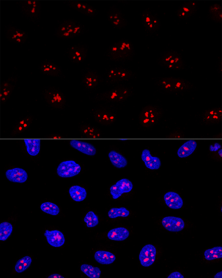 Confocal immunofluorescence analysis of U2OS cells using EBNA1BP2 Polyclonal Antibody at dilution of  1:200. Blue: DAPI for nuclear staining.