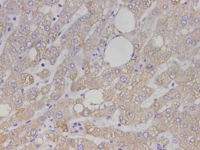 Immunohistochemistry of paraffin-embedded Human liver tissue using Maoa Polyclonal Antibody at dilution of 1:750(?400)