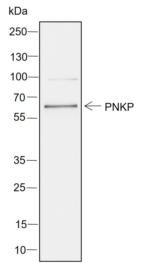 Recombinant PNKP Monoclonal Antibody - small - 1