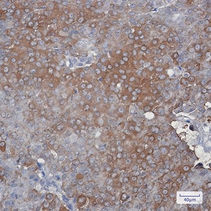 Recombinant Peroxiredoxin 2 Monoclonal Antibody - 2