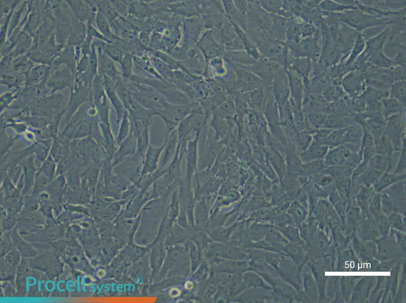 Rat Pulmonary Arteriolar Smooth Muscle Cell Complete Medium - 6