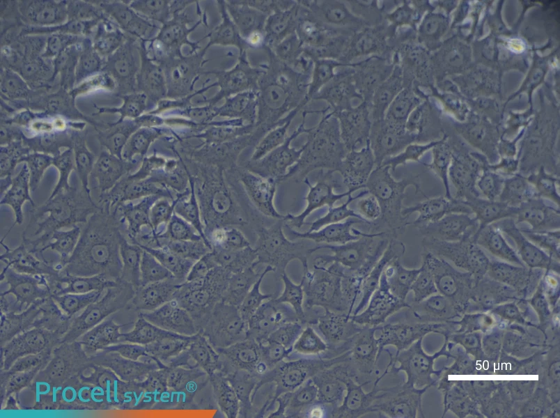 Human Type II Alveolar Epithelial (Primary cell immortalization) Cell Complete Medium - 6