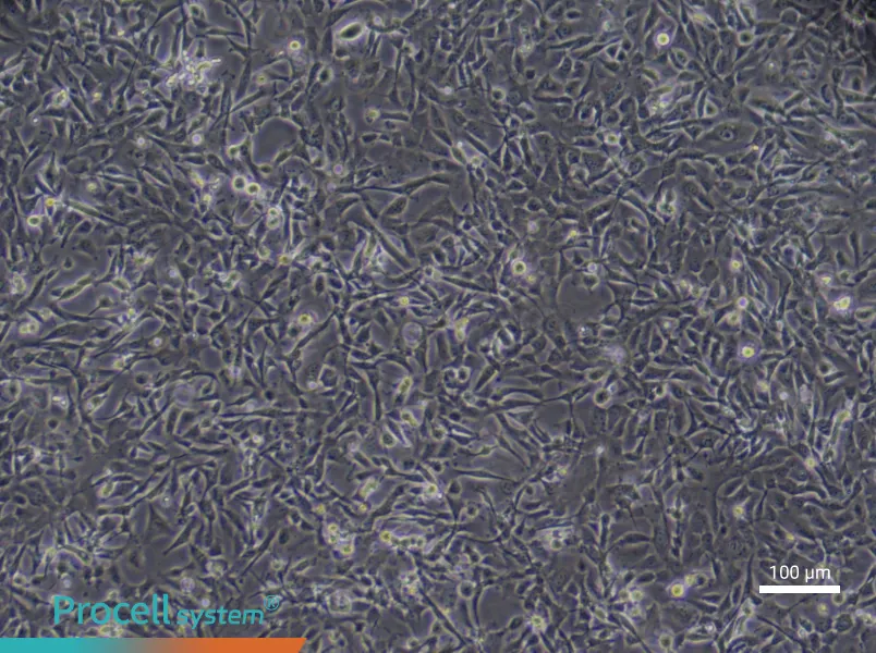 Human Cardiac Microvascular Endothelial (Primary cell immortalization) Cell Complete Medium - 3