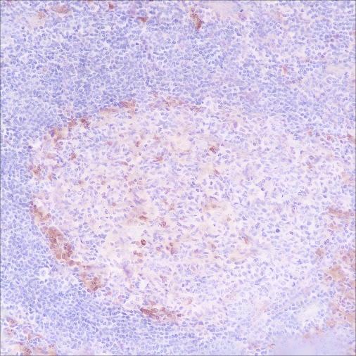 Recombinant VPAC1 Monoclonal Antibody - 2