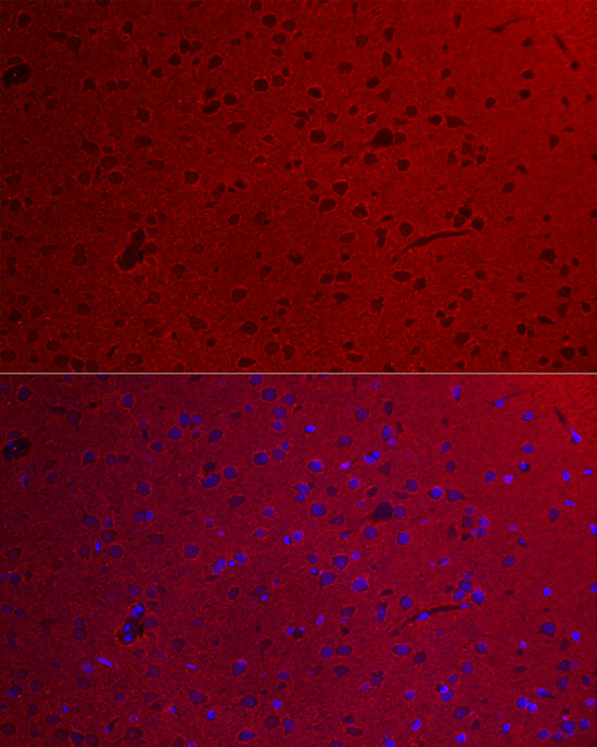 Immunofluorescence analysis of rat brain cells using GNAO1 Polyclonal antibody at dilution of 1:100 (40x lens). Blue: DAPI for nuclear staining.