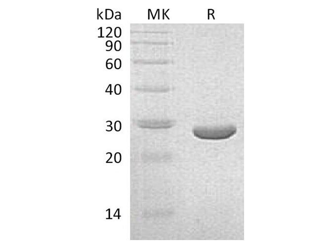 Recombinant Klebsiella pneumoniae NEO Protein