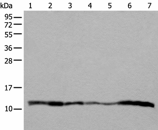 Western blot analysis of 293T A549 Hela and 231 cell Human placenta tissue HEPG2 cell Human fetal liver tissue lysates  using UQCRQ Polyclonal Antibody at dilution of 1:400