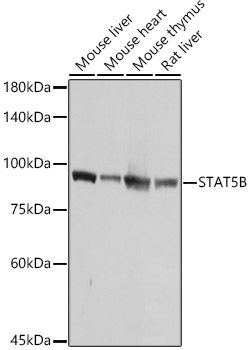 Western blot analysis of extracts of various cell lines using STAT5B Polyclonal Antibody at 1:1000 dilution.