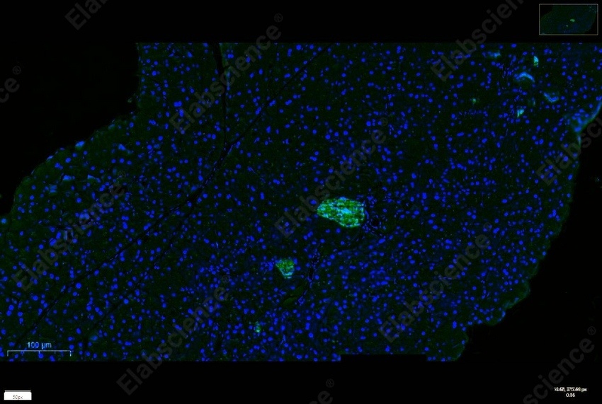 Recombinant Chromogranin A/CHGA/CGA Monoclonal Antibody - 8