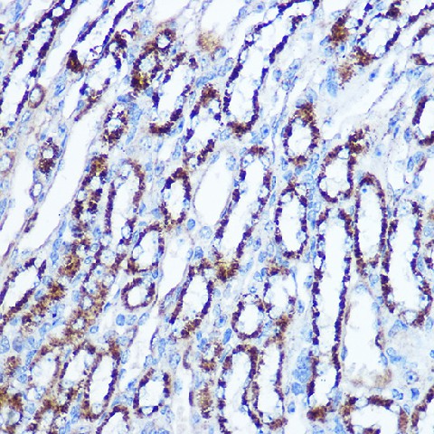 Immunohistochemistry of paraffin-embedded mouse kidney using SOD2 Polyclonal Antibody at dilution of 1:100 (40x lens).Perform microwave antigen retrieval with 10 mM Tris/EDTA buffer pH 9.0 before commencing with IHC staining protocol.