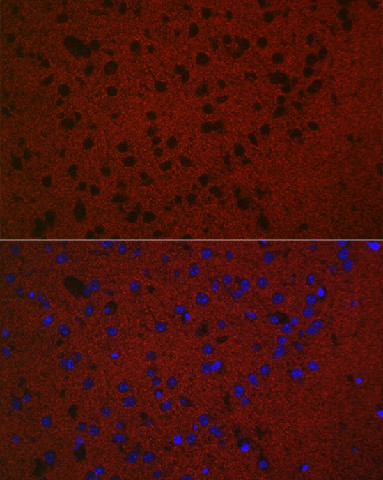 Immunofluorescence analysis of Mouse brain using RAB3A Polyclonal Antibody at dilution of 1:50. Blue: DAPI for nuclear staining.