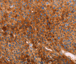 GC Polyclonal Antibody - 2