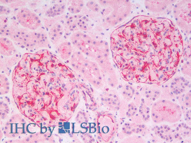 Immunohistochemistry analysis of paraffin-embedded Human Kidney using Vimentin Polyclonal Antibody(Elabscience Product Detected by Lifespan).