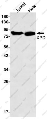 Recombinant XPD Monoclonal Antibody - 1