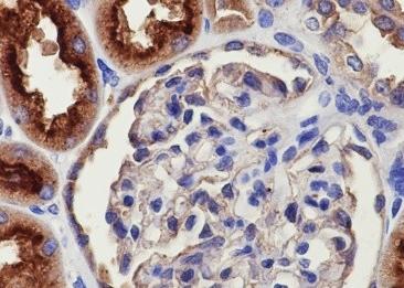 Recombinant DPP4/CD26 Monoclonal Antibody-searchlist-3