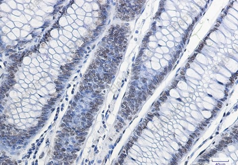 Recombinant Histone H2A.X Monoclonal Antibody - 4