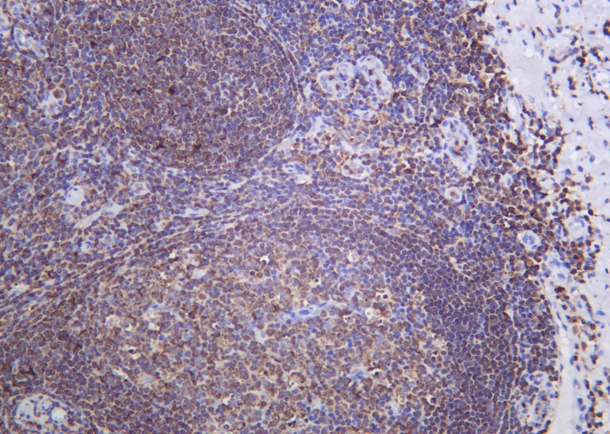 Recombinant SH-PTP1 Monoclonal Antibody-searchlist-1