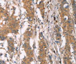 PLIN2 Polyclonal Antibody - 3