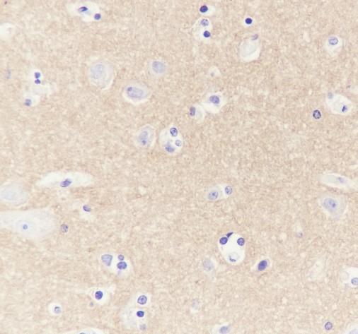 Recombinant CD90/Thy1 Monoclonal Antibody - 2