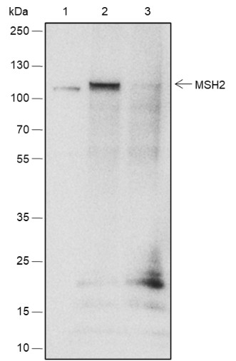 Recombinant MSH2 Monoclonal Antibody - small - 5