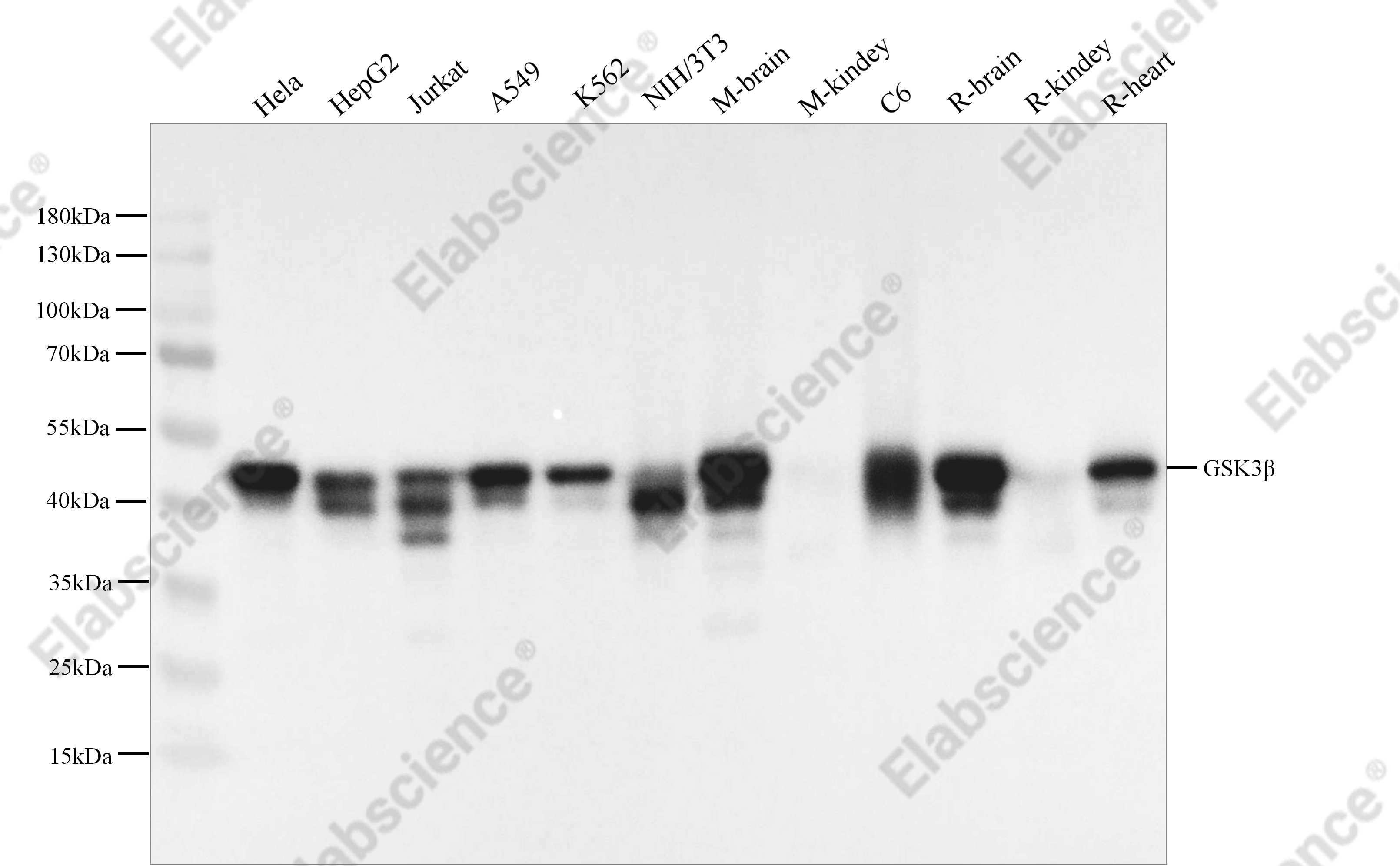 Recombinant GSK3β Monoclonal Antibody - 1