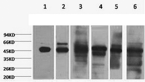 Western Blot analysis of 1) HepG2, 2) Hela, 3) Mouse liver, 4) C2C12, 5) Rat heart, 6) Mouse skeletal, muscle using CK-18 Monoclonal Antibody at dilution of 1:2000.