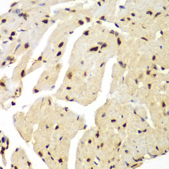 Immunohistochemistry of paraffin-embedded Mouse heart using LIG3 Polyclonal Antibody at dilution of  1:100 (40x lens).